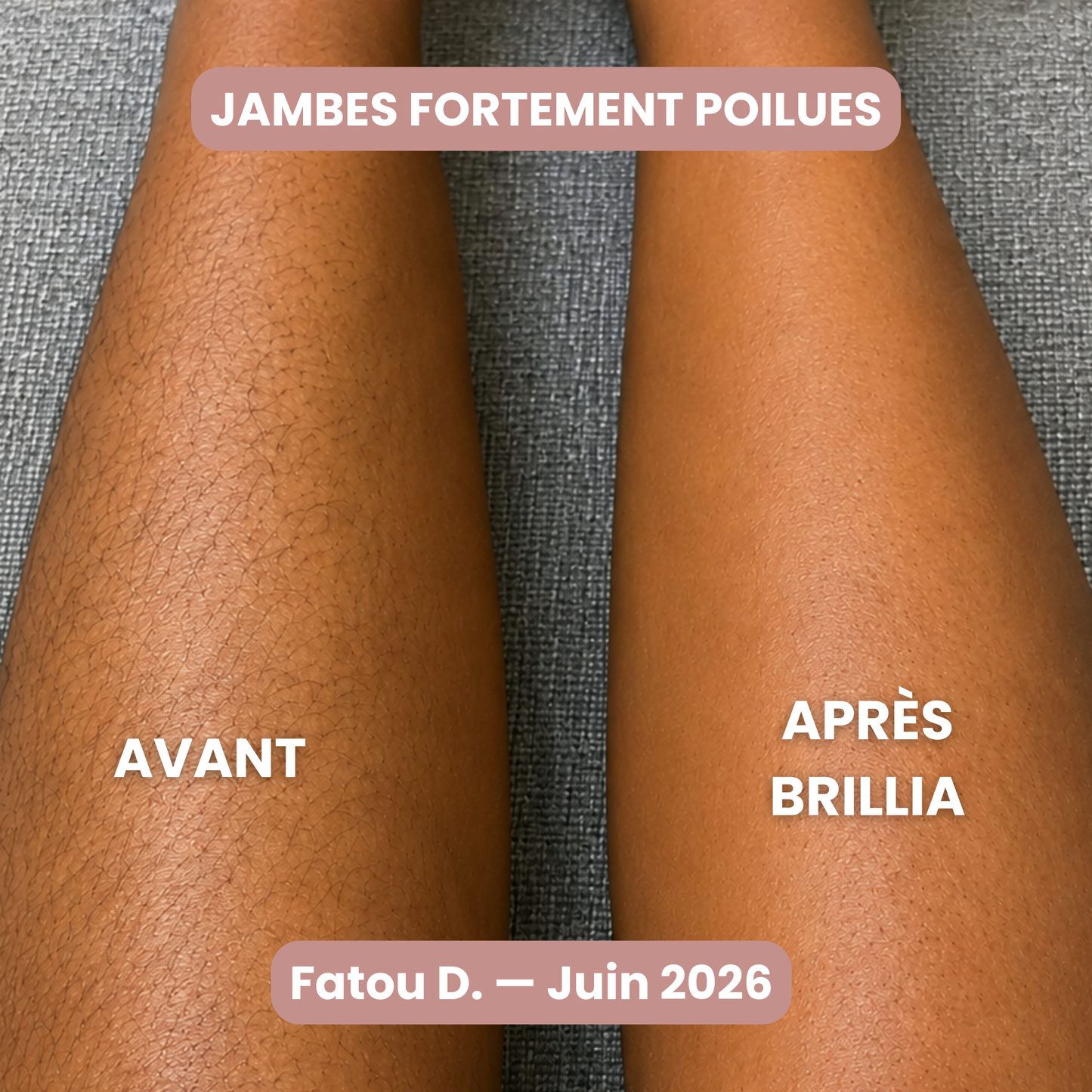 Rasoir Brillia® 2-en-1 Tondeuse & Rasoir Étanche pour Bikini, Jambes & Corps.