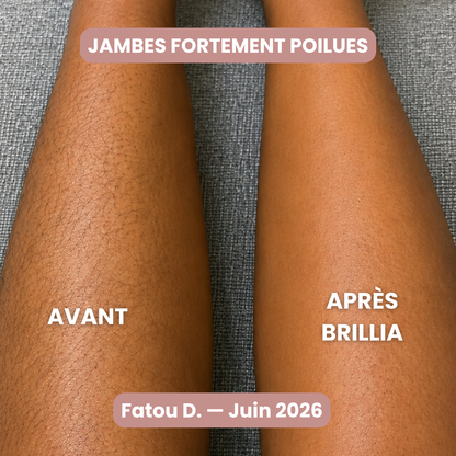 Rasoir Brillia® 2-en-1 Tondeuse & Rasoir Étanche pour Bikini, Jambes & Corps.