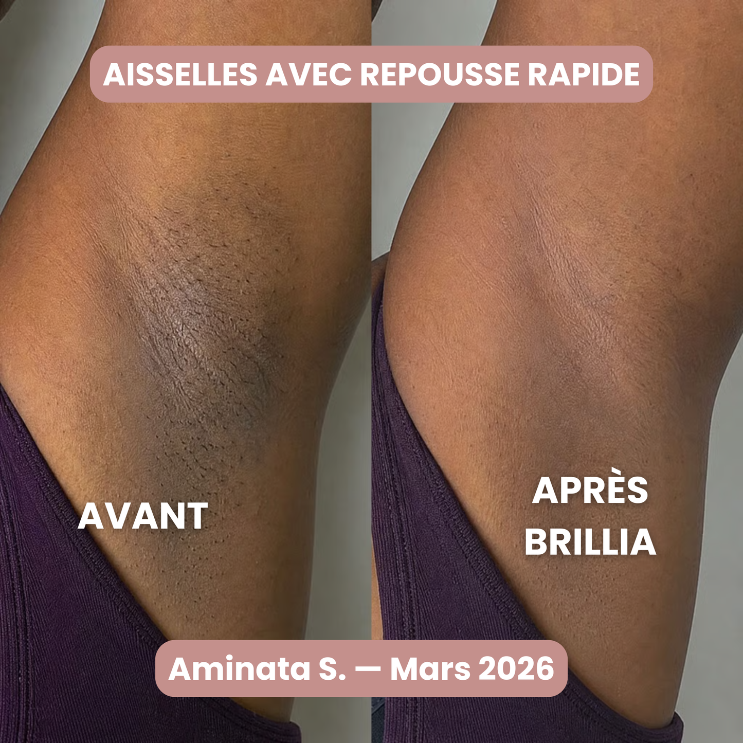 Rasoir Brillia® 2-en-1 Tondeuse & Rasoir Étanche pour Bikini, Jambes & Corps.